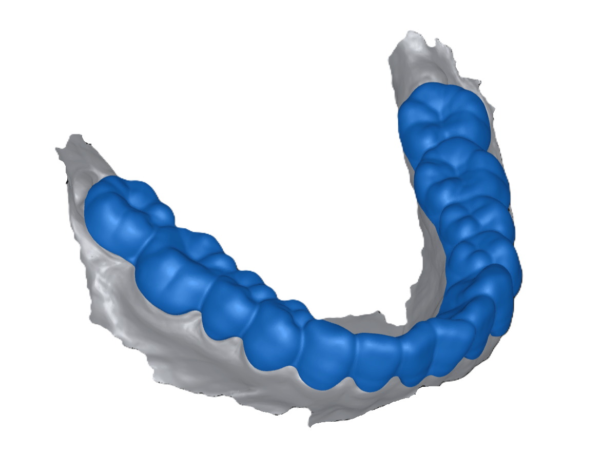 Retainer Models