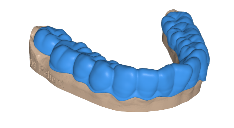 Production-Ready Retainer Model