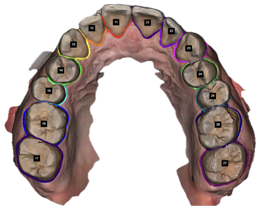 Image Segmentation