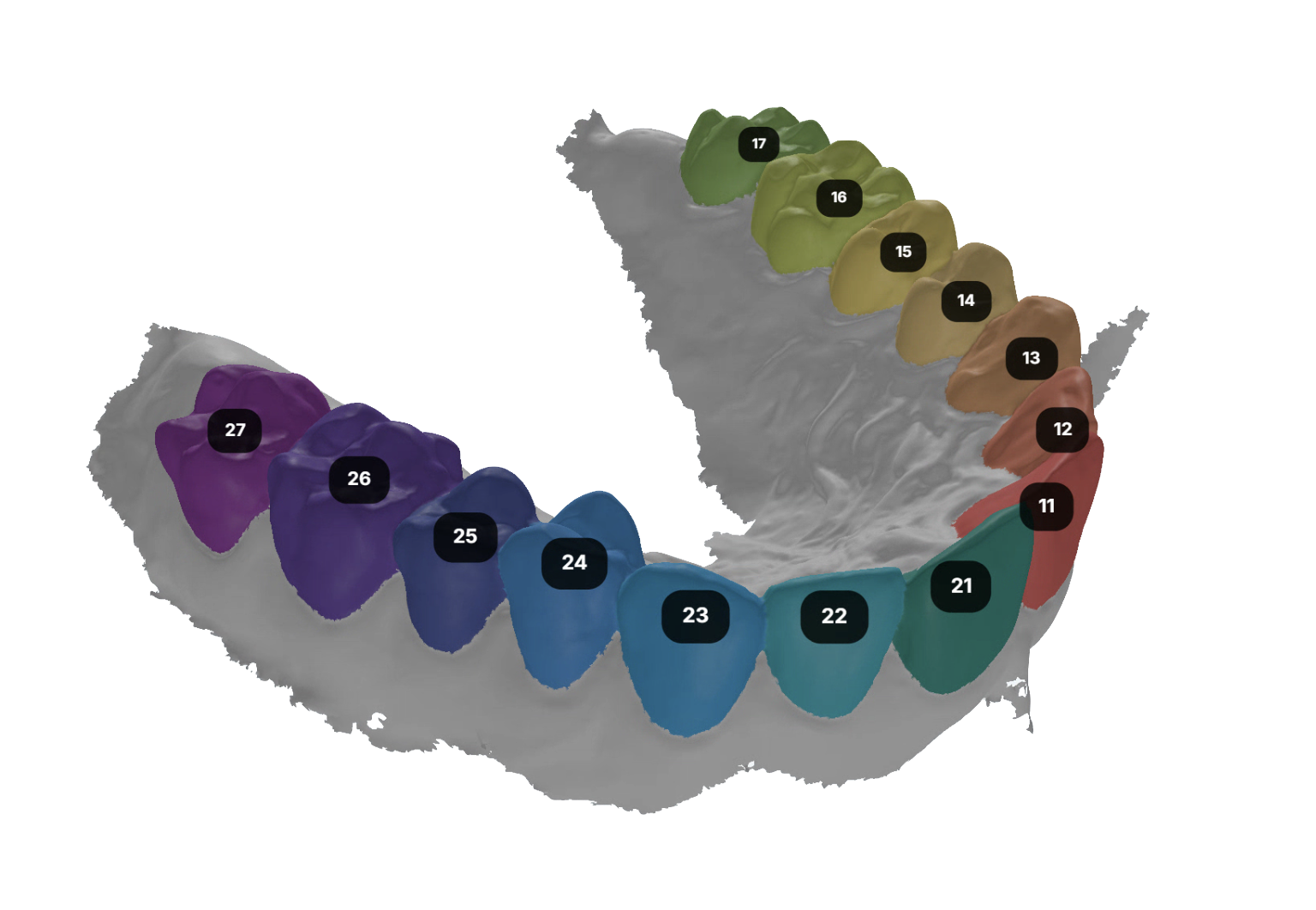 Intraoral Scan Segmentation